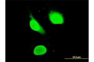 Immunofluorescence of monoclonal antibody to IKZF3 on HeLa cell. (IKZF3 抗体  (AA 1-509))