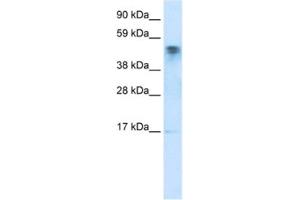 Western Blotting (WB) image for anti-FLJ13798 (FLJ13798) antibody (ABIN2460760) (FLJ13798 (FLJ13798) 抗体)