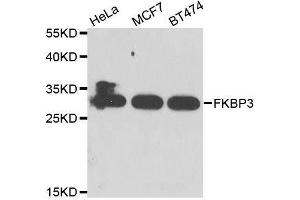 Western blot analysis of extracts of various cell lines, using FKBP3 antibody. (FKBP3 抗体  (AA 1-224))
