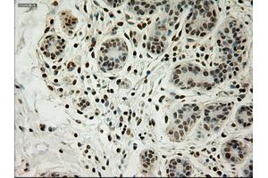 Immunohistochemical staining of paraffin-embedded breast tissue using anti-L1CAM mouse monoclonal antibody. (L1CAM 抗体)