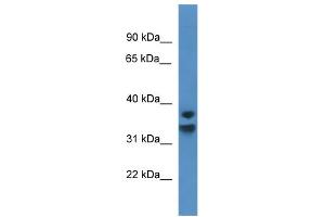 WB Suggested Anti-NFKBID Antibody Titration: 0. (NFKBID 抗体  (C-Term))