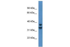 Western Blotting (WB) image for anti-Nuclear Factor of kappa Light Polypeptide Gene Enhancer in B-Cells Inhibitor, delta (NFKBID) (C-Term) antibody (ABIN2788526)