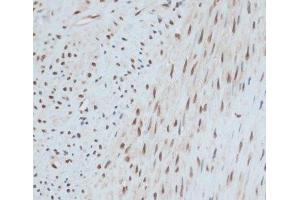 Immunohistochemistry (Paraffin-embedded Sections) (IHC (p)) image for anti-Zinc Finger Protein 433 (ZNF433) antibody (ABIN7258240)