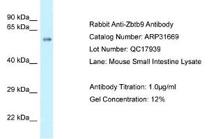 WB Suggested Anti-Zbtb9 Antibody   Titration: 1. (ZBTB9 抗体  (C-Term))