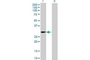 Western Blot analysis of ARGLU1 expression in transfected 293T cell line by ARGLU1 MaxPab polyclonal antibody. (ARGLU1 抗体  (AA 1-273))