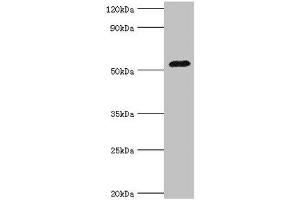 Western blot All lanes: Angiotensinogen antibody at 3 μg/mL + Mouse liver tissue Secondary Goat polyclonal to rabbit IgG at 1/10000 dilution Predicted band size: 53 kDa Observed band size: 53 kDa (AGT 抗体  (AA 35-285))