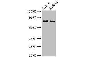 Western Blot Positive WB detected in: Mouse liver tissue, Mouse kidney tissue All lanes: PHF21A antibody at 3 μg/mL Secondary Goat polyclonal to rabbit IgG at 1/50000 dilution Predicted band size: 75, 71 kDa Observed band size: 75 kDa (PHF21A 抗体  (AA 312-487))