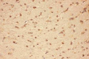 Immunohistochemistry (IHC) image for anti-Ciliary Neurotrophic Factor (CNTF) (AA 2-198) antibody (ABIN3042752)