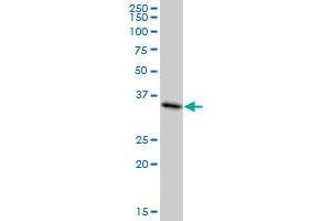 MDH1 monoclonal antibody (M01), clone 2B11-B7. (MDH1 抗体  (AA 1-334))
