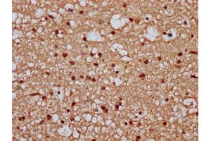 IHC image of ABIN7171666 diluted at 1:300 and staining in paraffin-embedded human brain tissue performed on a Leica BondTM system. (Tiparp 抗体  (AA 74-178))