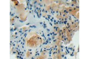 IHC-P analysis of lung tissue, with DAB staining. (DOCK2 抗体  (AA 390-635))
