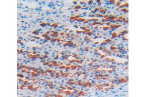 Used in DAB staining on fromalin fixed paraffin- embedded stomach tissue (LOXL2 抗体  (AA 553-761))