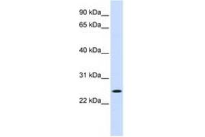 Image no. 1 for anti-Nucleolar Protein 3 (Apoptosis Repressor with CARD Domain) (NOL3) (C-Term) antibody (ABIN6744368) (NOL3 抗体  (C-Term))