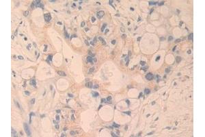 Immunohistochemistry (IHC) image for anti-Cysteine-Rich, Angiogenic Inducer, 61 (CYR61) (AA 178-381) antibody (ABIN7436243)
