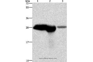 Western blot analysis of Mouse brain and kidney tissue, human fetal brain tissue, using CALB1 Polyclonal Antibody at dilution of 1:750 (CALB1 抗体)
