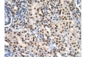 Immunohistochemistry (IHC) image for anti-Ras Suppressor Protein 1 (RSU1) (C-Term) antibody (ABIN2783331) (RSU1 抗体  (C-Term))