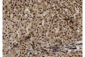 ABIN6272981 at 1/100 staining Human liver tissue by IHC-P. (SULT1E1 抗体  (Internal Region))
