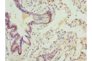 Immunohistochemistry of paraffin-embedded human lung tissue using ABIN7144880 at dilution of 1:100 (ABCA3 抗体  (AA 43-203))
