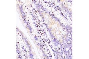 Immunohistochemistry of paraffin embedded rat ileum using ASBT (ABIN7075648) at dilution of 1:1500 (400x lens) (SLC10A2 抗体)