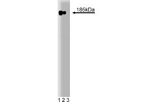 Western Blotting (WB) image for anti-Receptor tyrosine-protein kinase erbB-2 (ErbB2/Her2) (AA 182-373) antibody (ABIN967787) (ErbB2/Her2 抗体  (AA 182-373))