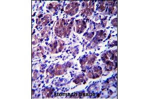 CCDC22 Antibody (C-term) (ABIN657403 and ABIN2846443) immunohistochemistry analysis in formalin fixed and paraffin embedded human stomach tissue followed by peroxidase conjugation of the secondary antibody and DAB staining. (CCDC22 抗体  (C-Term))