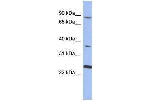 WB Suggested Anti-MPP3 Antibody Titration: 0. (MPP3 抗体  (N-Term))