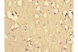Immunohistochemistry of paraffin-embedded human brain tissue using ABIN7151461 at dilution of 1:100 (EHD3 抗体  (AA 269-498))