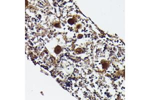 Immunohistochemistry of paraffin-embedded rat bone marrow using CXCL4/PF4 Rabbit pAb (ABIN7269400) at dilution of 1:50 (40x lens). (PF4 抗体)