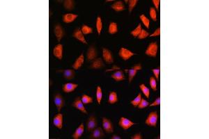 Immunofluorescence analysis of L929 cells using KIF Rabbit pAb (ABIN1680591, ABIN3019005, ABIN3019006 and ABIN6220670) at dilution of 1:100. (KIFAP3 抗体  (AA 1-200))
