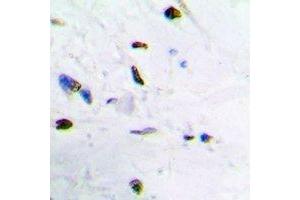 Immunohistochemical analysis of ZNF307 staining in human brain formalin fixed paraffin embedded tissue section.