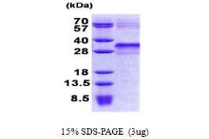 Insulin-Like Growth Factor Binding Protein 6 (IGFBP6) (AA 28-240) protein (His tag)