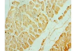 Immunohistochemistry of paraffin-embedded human heart tissue using ABIN7142987 at dilution of 1:100 (ASAH1 抗体  (AA 146-395))