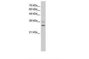 Image no. 1 for anti-Forkhead Box Q1 (FOXQ1) (N-Term) antibody (ABIN6736598) (FOXQ1 抗体  (N-Term))