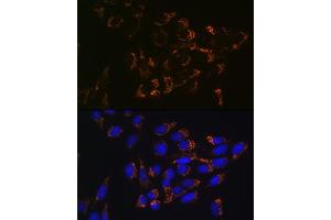 anti-Glutaminase (GLS) antibody