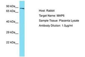 MAP6 抗体  (AA 360-409)