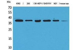 Western Blotting (WB) image for anti-Ribosomal RNA Processing 7 Homolog A (RRP7A) (C-Term) antibody (ABIN3178144) (RRP7A 抗体  (C-Term))