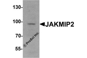 Western Blotting (WB) image for anti-Janus Kinase and Microtubule Interacting Protein 2 (JAKMIP2) antibody (ABIN1077420) (JAKMIP2 抗体)