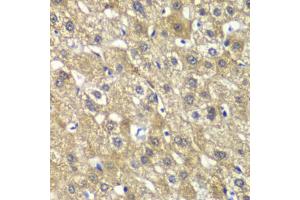 Immunohistochemistry of paraffin-embedded human liver injury using MYBPC2 antibody (ABIN6291568) at dilution of 1:100 (40x lens). (MYBPC2 抗体)