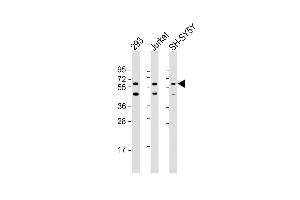 Western Blot at 1:2000 dilution Lane 1: 293 whole cell lysate Lane 2: Jurkat whole cell lysate Lane 3: SH-SY5Y whole cell lysate Lysates/proteins at 20 ug per lane. (HEXDC 抗体  (AA 135-166))
