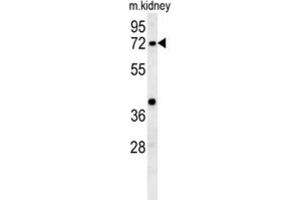 Western Blotting (WB) image for anti-Kelch-Like 6 (KLHL6) antibody (ABIN3002443) (KLHL6 抗体)