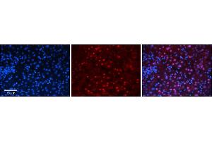 Rabbit Anti-ZNF419 Antibody      Formalin Fixed Paraffin Embedded Tissue: Human Adult Liver   Observed Staining: Nuclear in hepatocytes, strong signal, wide tissue distribution  Primary Antibody Concentration: 1:100  Secondary Antibody: Donkey anti-Rabbit-Cy3  Secondary Antibody Concentration: 1:200  Magnification: 20X  Exposure Time: 0. (ZNF419 抗体  (N-Term))