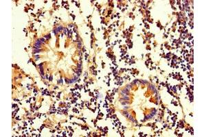 Immunohistochemistry of paraffin-embedded human appendix tissue using ABIN7162111 at dilution of 1:100 (OLA1 抗体  (AA 1-396))