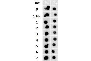 Dot blot analysis using Rabbit Anti-Amyloid Fibrils (OC) Polyclonal Antibody . (Amyloid 抗体 (Biotin))