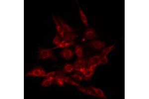 ABIN6266473 staining HuvEc by IF/ICC. (ALOX5 抗体  (pSer523))
