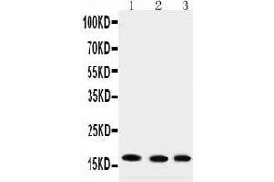 Western Blotting (WB) image for anti-Ubiquitin-Conjugating Enzyme E2I (UBE2I) (AA 108-122), (C-Term) antibody (ABIN3042573) (UBE2I 抗体  (C-Term))