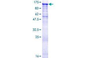 STK31 Protein (AA 1-1019) (GST tag)