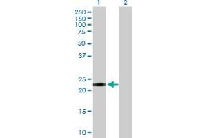 Western Blot analysis of GLIPR1L1 expression in transfected 293T cell line by GLIPR1L1 MaxPab polyclonal antibody. (GLIPR1L1 抗体  (AA 1-233))