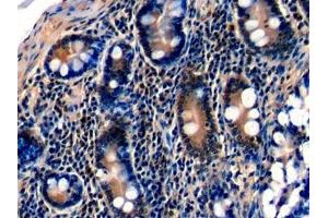 Immunohistochemistry (IHC) image for anti-Antigen Identified By Monoclonal Antibody Ki-67 (MKI67) (AA 2815-2928) antibody (ABIN7434599)