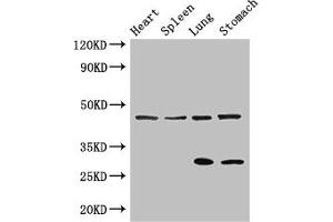 Western Blot Positive WB detected in: Mouse heart tissue, Mouse spleen tissue, Mouse lung tissue, Mouse stomach tissue All lanes: REN antibody at 3 μg/mL Secondary Goat polyclonal to rabbit IgG at 1/50000 dilution Predicted band size: 46, 45 kDa Observed band size: 46, 29 kDa (Renin 抗体  (AA 229-398))