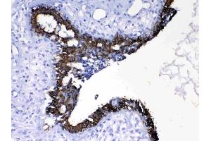IHC analysis of Cytokeratin 8 using anti- Cytokeratin 8 antibody . (KRT8 抗体  (AA 107-325))